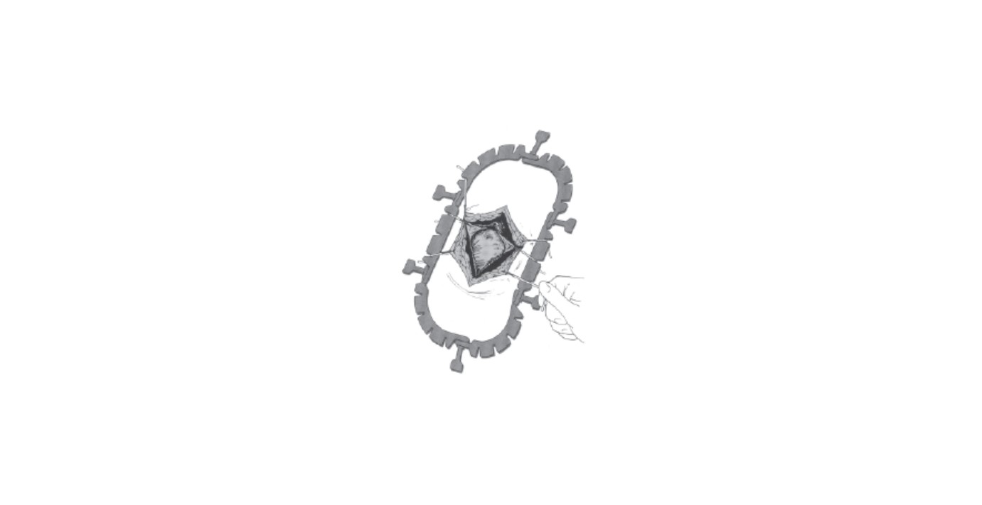 A drawing of an oval shaped object with a chain link around it.